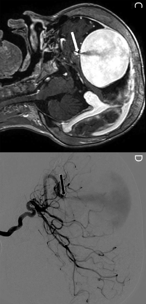 网投十大信誉可靠平台：
Neurology：『喷泉』(图4)